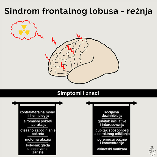 Sindrom frontalnog lobusa, rezanj, trauma, pareza, hemipareza, hemiplegija