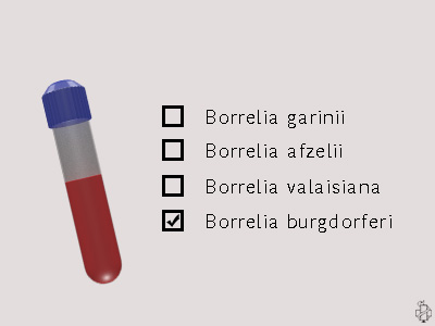 dijagnoza lajmske bolesti, borrelia, borelia, borelia burgdorferi, borrelia garinii